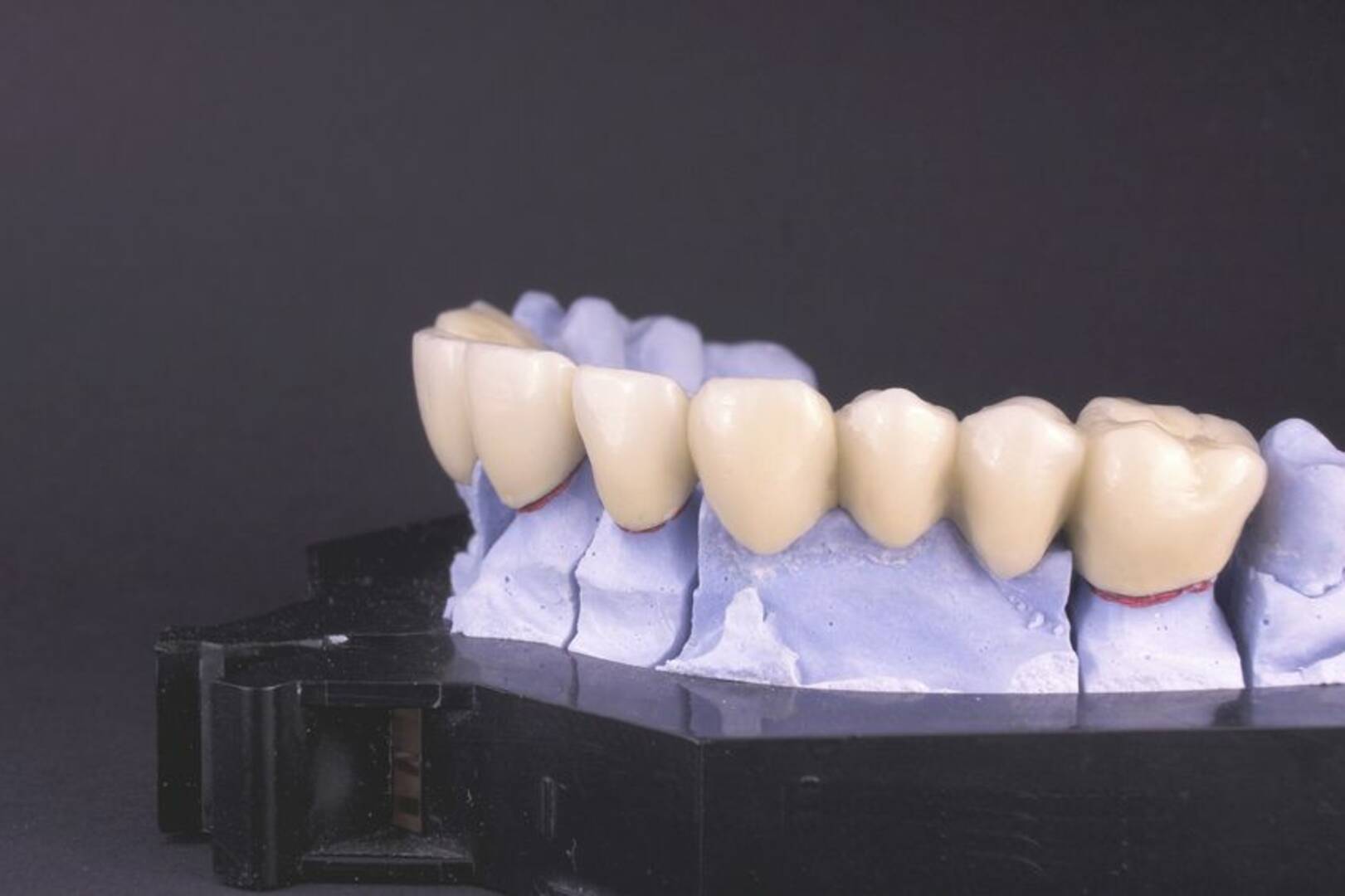 Cosmetic Dentistry Lauderdale By The Sea FL